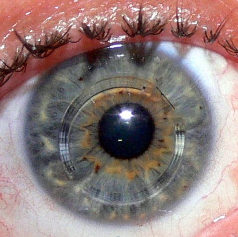 Chorujesz na stożek rogówki? Przeczytaj koniecznie.