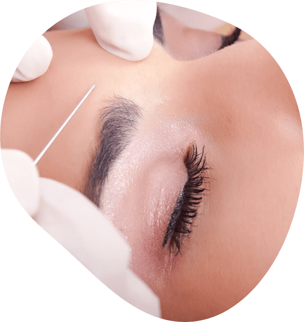 What does the procedure involve?