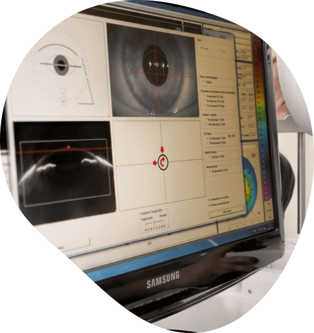 Specialized contact lenses