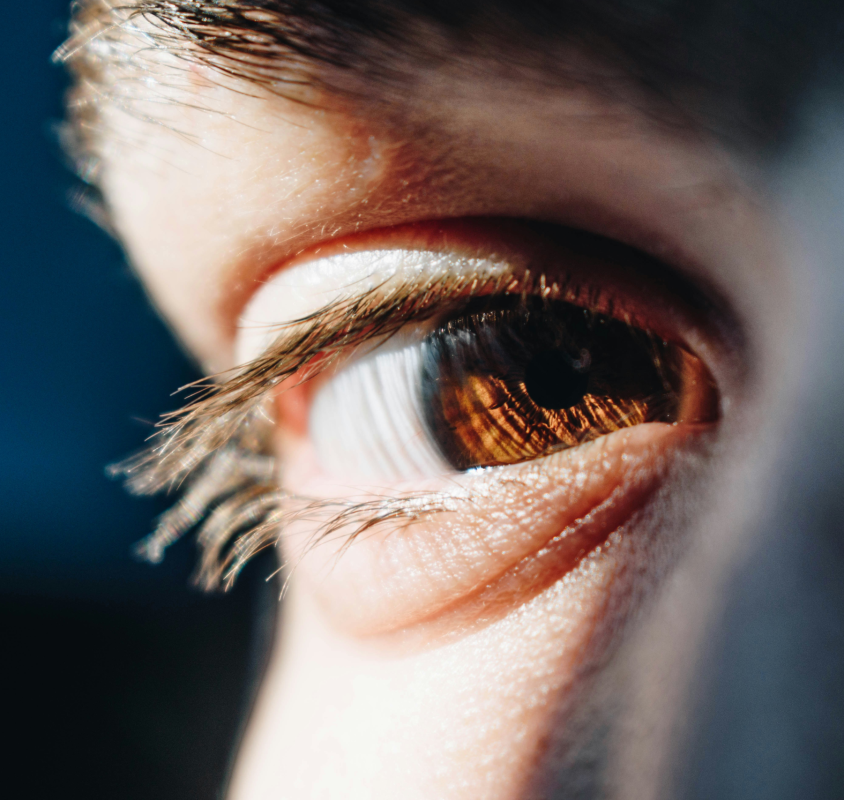 Zwyrodnienie plamki żółtej – przyczyny, objawy, leczenie