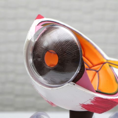 Czerwona kropka na oku – co oznacza i czy jest niebezpieczna?