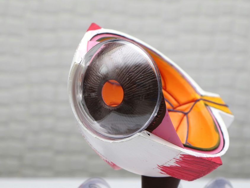 Czerwona kropka na oku – co oznacza i czy jest niebezpieczna?