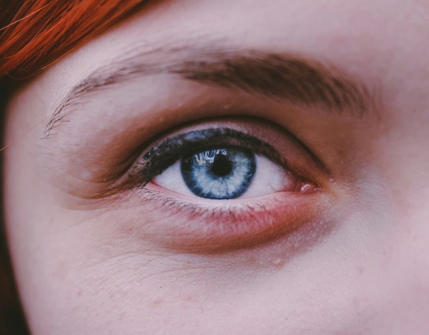 Jęczmień na oku – domowe sposoby na jęczmień