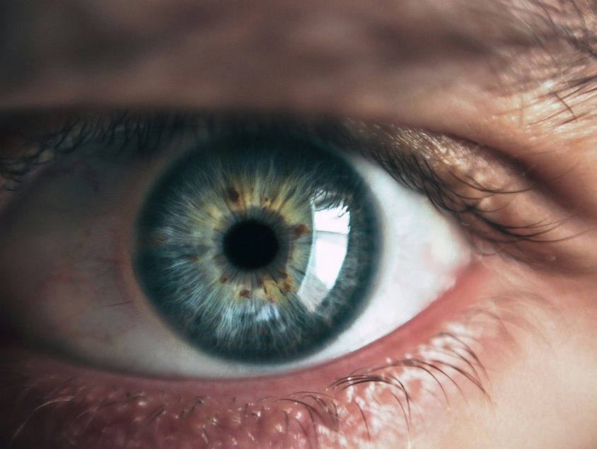 Opadająca powieka (ptoza) – przyczyny, objawy i leczenie