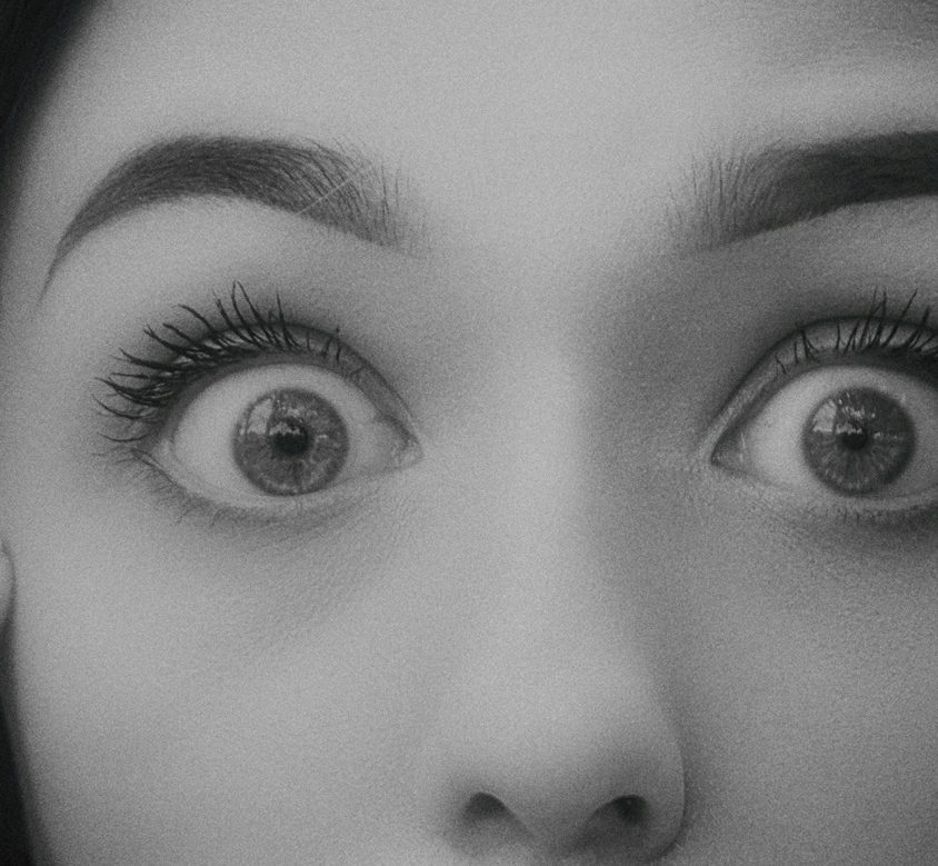 Wytrzeszcz oczu – przyczyny, objawy i leczenie