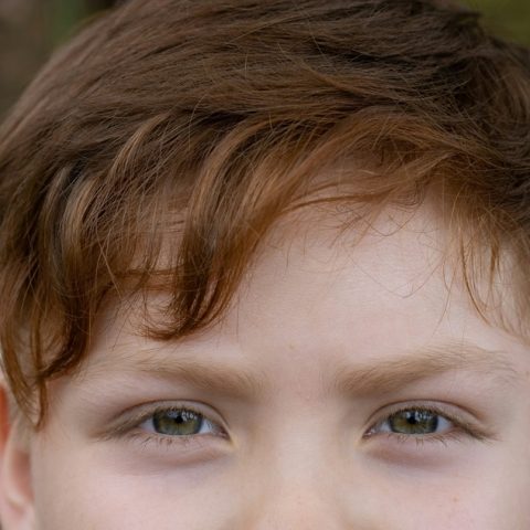 Podkrążone oczy u dziecka