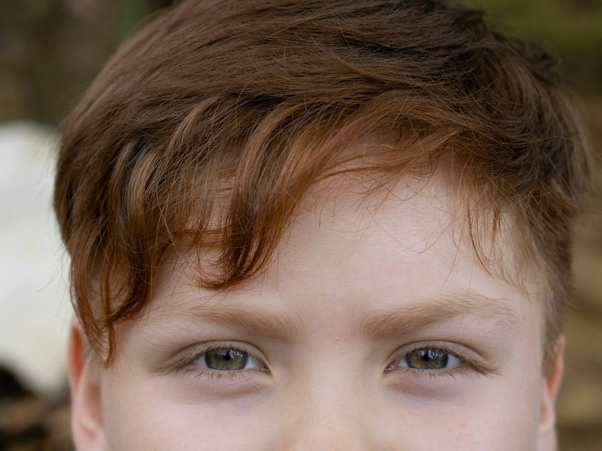 Podkrążone oczy u dziecka