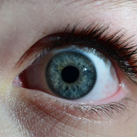 Niebieska twardówka – przyczyny i metody leczenia