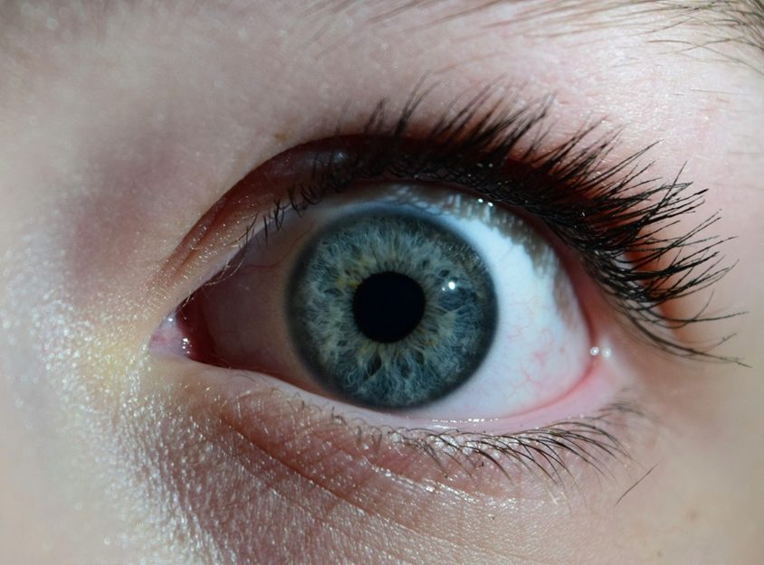 Niebieska twardówka – przyczyny i metody leczenia